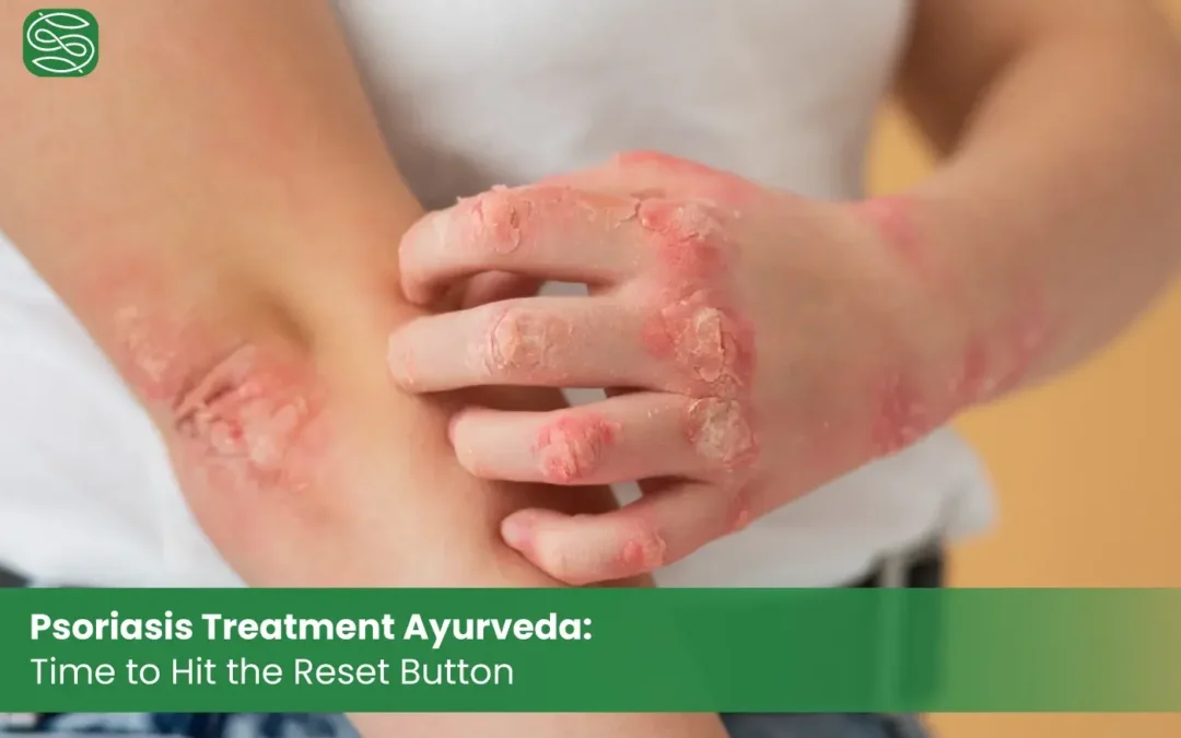 Psoriasis Treatment Ayurveda -Time to Hit the Reset Button banner image